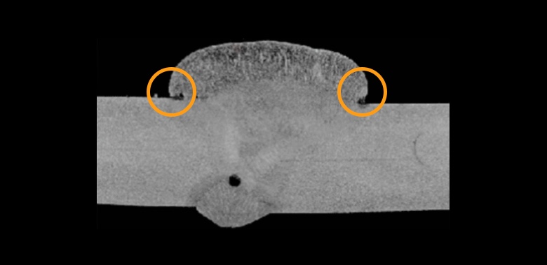 overlap radiography